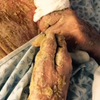 Böcekler canlı canlı yedi... Eski model hayatını kaybetti!