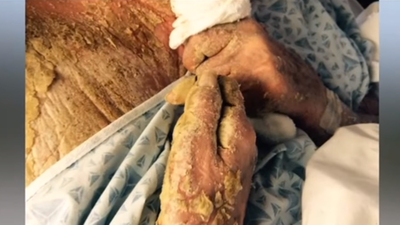 Böcekler canlı canlı yedi... Eski model hayatını kaybetti!