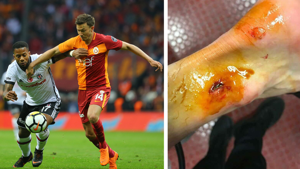 Linnes ucuz kurtulmuş!