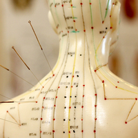 Akupunktur pek çok hastalıkta kullanılıyor! İşte o hastalıklar...