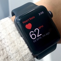 Apple Watch genç kızın hayatını kurtardı!