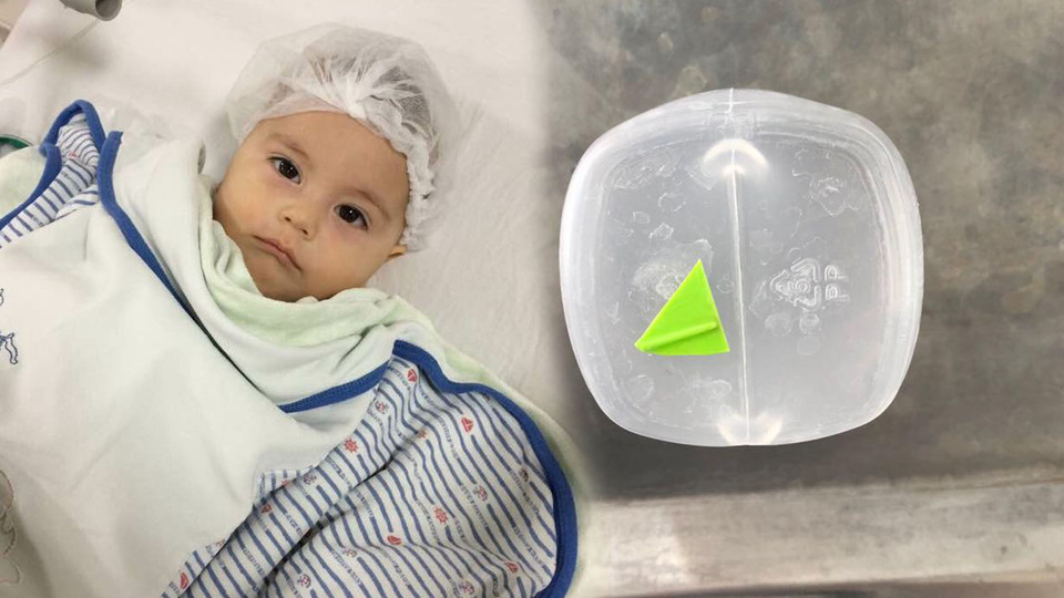 Yuttuğu oyuncakla 6 ay yaşadı