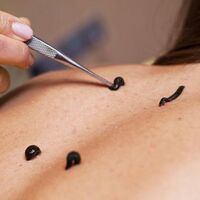 Dikkat! İnsandan insana hastalık taşıyabiliyorlar...