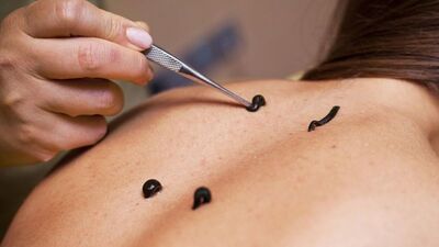 Dikkat! İnsandan insana hastalık taşıyabiliyorlar...