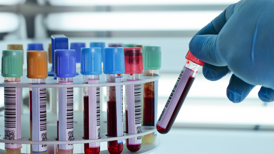 Tıpta devrim! Kan testinde hepsi belli olacak