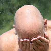 O çalışma prestijli tıp dergisinde yayımlandı! Kellik tarih mi oluyor?