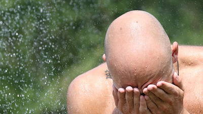 O çalışma prestijli tıp dergisinde yayımlandı! Kellik tarih mi oluyor?