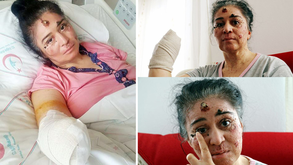 Tıp karşısında çaresiz! Doktorları bile şoke etti!