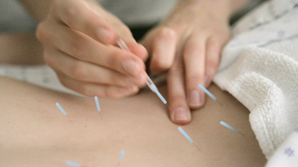 Ramazan ayında akupunktur ile kilo vermek sağlıklı mı?