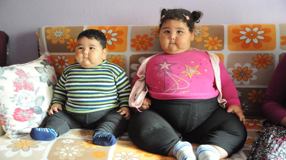 2,5 yaşında 50 kilo oldu!