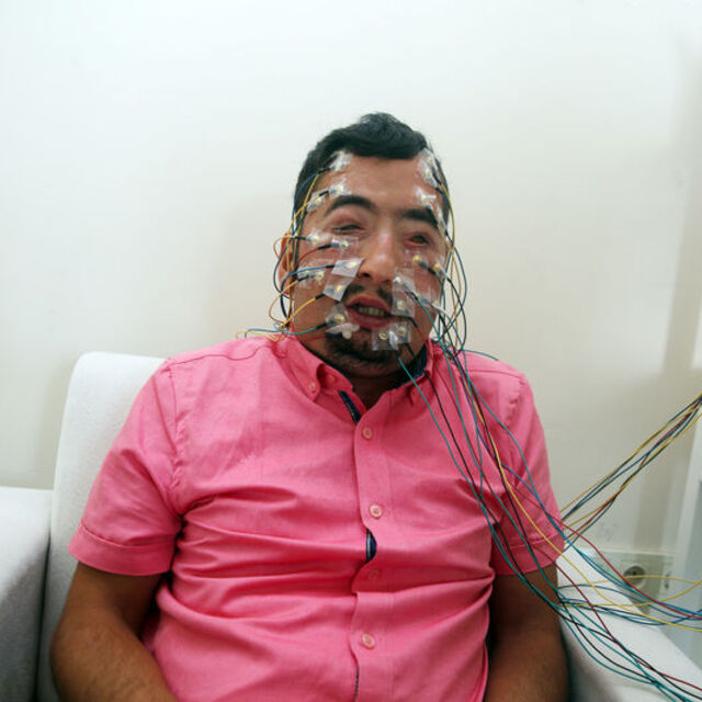 6 yıl sonra gözlerini açıp kapamaya başladı!