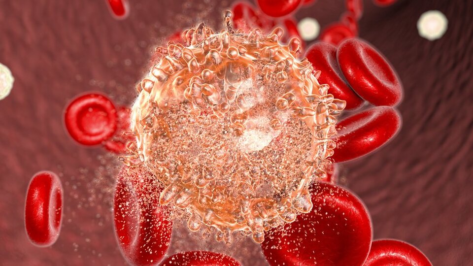 Fazla hijyenik yaşam çocuklarda 'lösemiye yol açıyor'