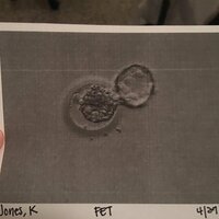 Gelininin bebeğini doğurdu!