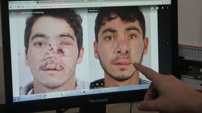 Dağılan yüzünü böyle birleştirdiler!