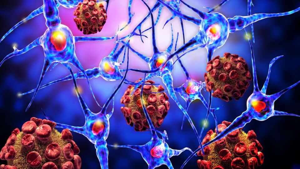 MS 20-40'lı yaşları vuruyor!