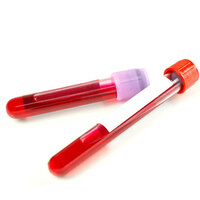 İğne yaptırmak veya kan aldırmak orucu bozar mı?