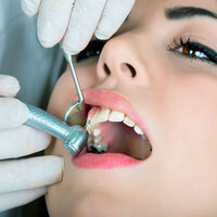 Diş çektirmek orucu bozar mı?