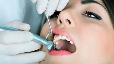 Diş çektirmek orucu bozar mı?