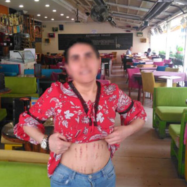 Güzellik merkezinde vücudu bu hale geldi