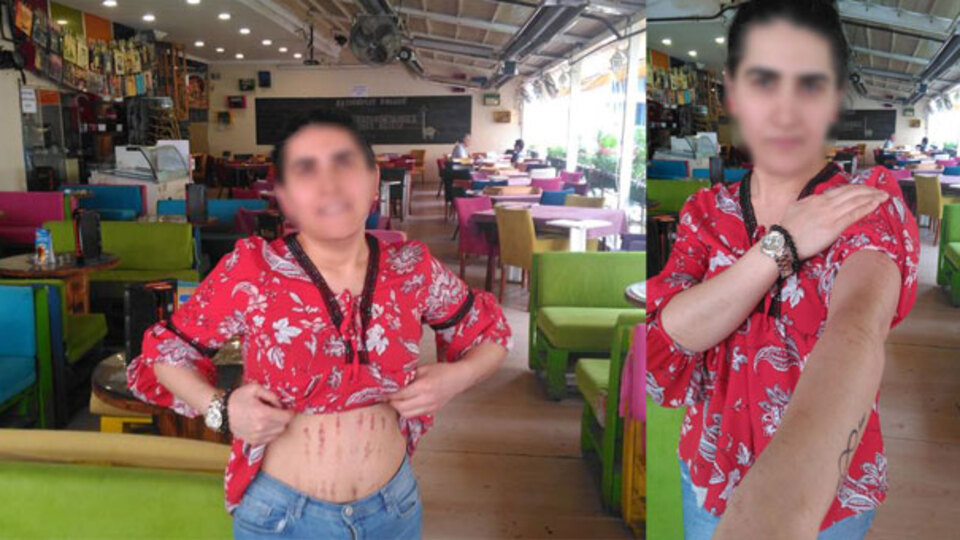 Güzellik merkezinde vücudu bu hale geldi