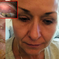 25 yıl yüzünü yıkamadı! Gözünden çıkanlar şoke etti!