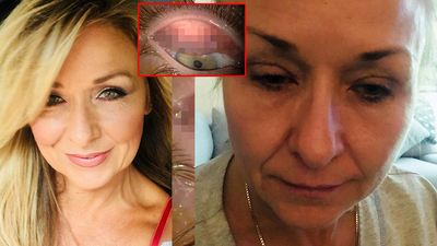 25 yıl yüzünü yıkamadı! Gözünden çıkanlar şoke etti!