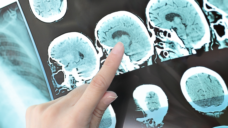 Bilim insanları bunu ilk kez başardı!