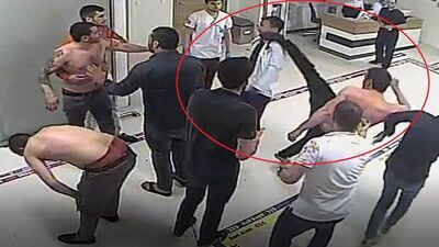 Doktorun burnunu ve uyluk kemiğini kırdılar!
