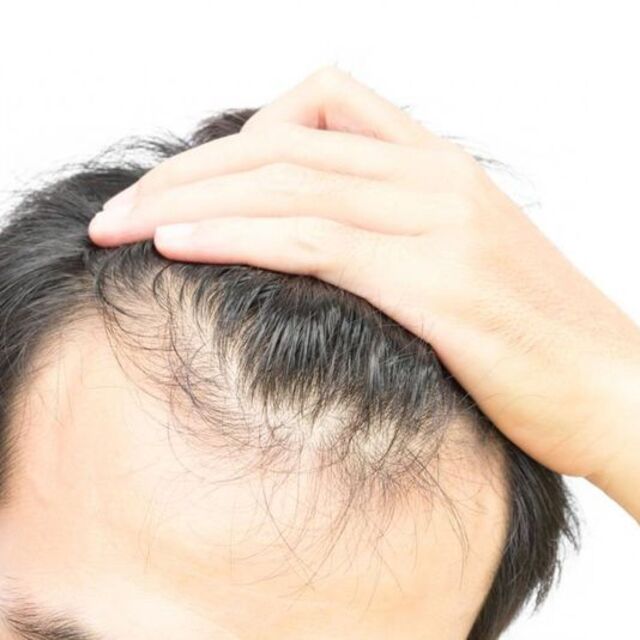 Sağlık Bakanlığı’ndan saç ekimi uyarısı!