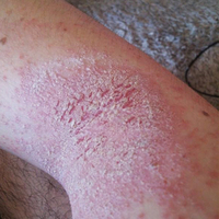 Dikkat! Sizin de başınıza gelebilir! Sabundaki büyük tehlike!