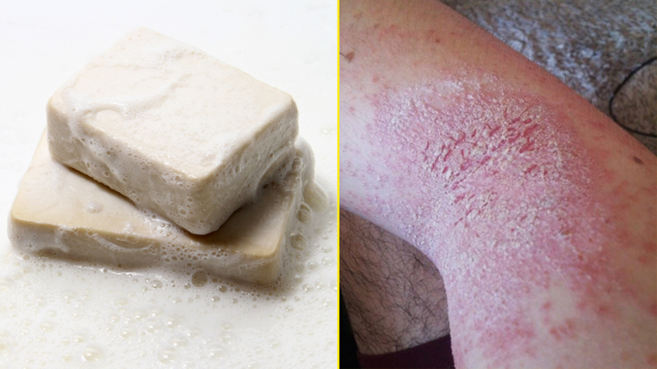 Dikkat! Sizin de başınıza gelebilir! Sabundaki büyük tehlike!