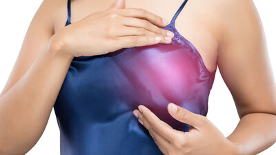 Meme kanserinde radyoterapinin süresi kısalıyor!