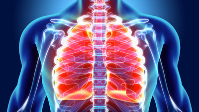 Yeni bir kanser tipi tespit edildi!