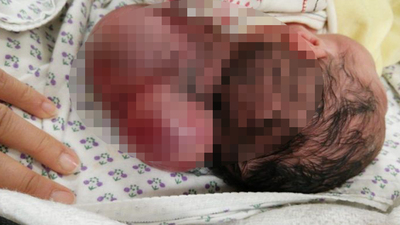 O ilde iki kafalı bebek dünyaya geldi!