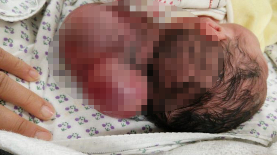 O ilde iki kafalı bebek dünyaya geldi!