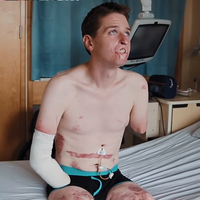 Onun hayatı herkesinkinden daha zor! İşte son hali...