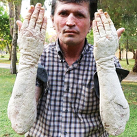 23 yıl önce başladı! "Beni gören korkup kaçıyor"