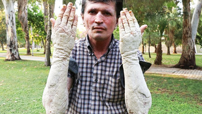23 yıl önce başladı! "Beni gören korkup kaçıyor"