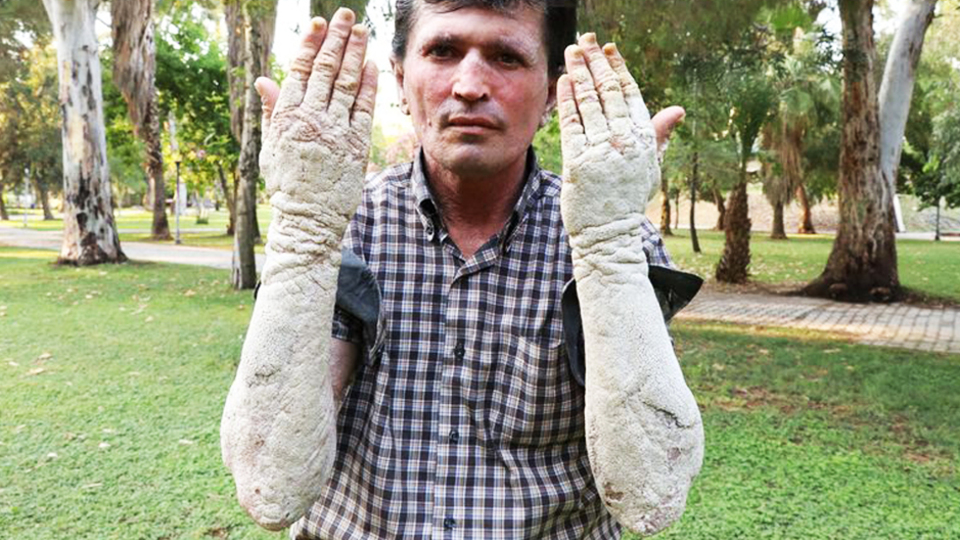 23 yıl önce başladı! "Beni gören korkup kaçıyor"