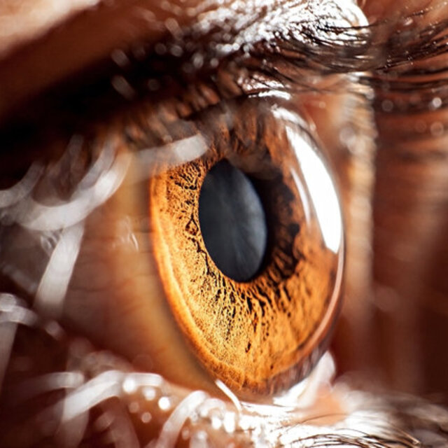 Göz önünde uçuşan sineklere dikkat!