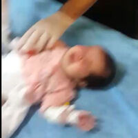 Sağlık personeli bebeğin parmağını kesmişti! O bebekten haber var!