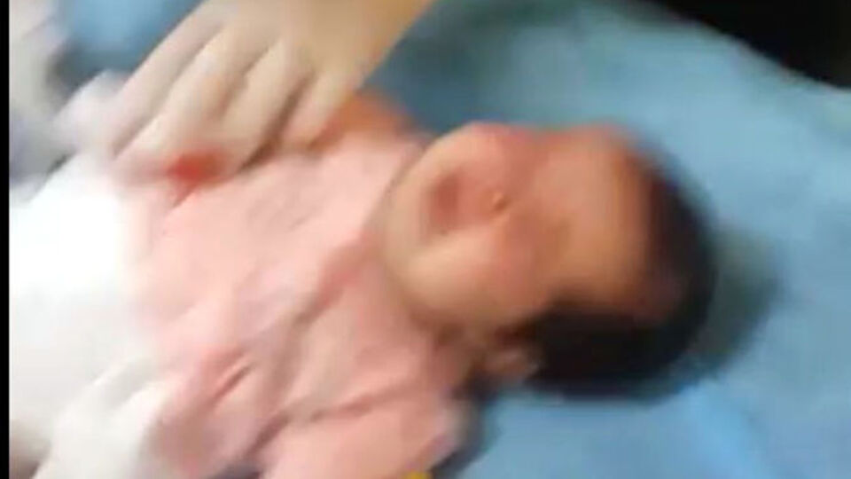 Sağlık personeli bebeğin parmağını kesmişti! O bebekten haber var!