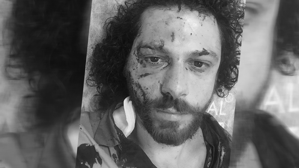 Kadıköy'deki bar saldırısında ünlü oyuncu yaralandı!
