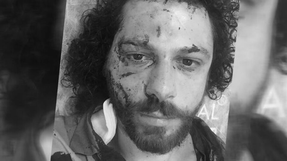 Ünlü oyuncunun yaralandığı bar saldırısının görüntüleri ortaya çıktı