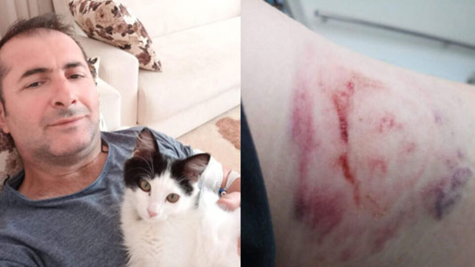 Hastanede dehşet! Kolunu ısırdı...