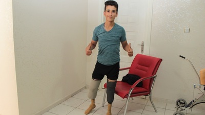 İsmail protez bacakla hayata bağlandı