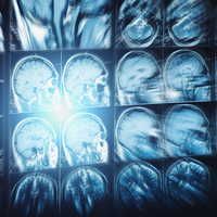 Sıcak hava beyin yakıyor!