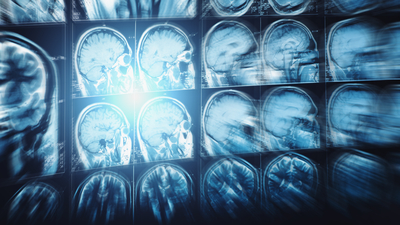 Sıcak hava beyin yakıyor!