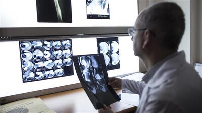 İlk kez insan üzerinde denendi!