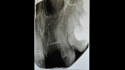 Kaza geçirdi! Asla olmaz diye düşündüğü şey oldu!